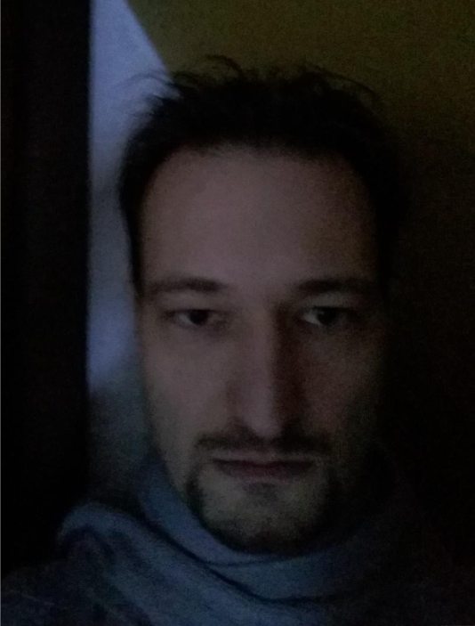 Low-light image with visible sensor noise across the face