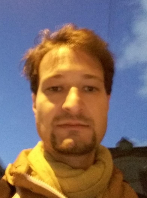 Warm-coloured lighting flattening the contrast of the face