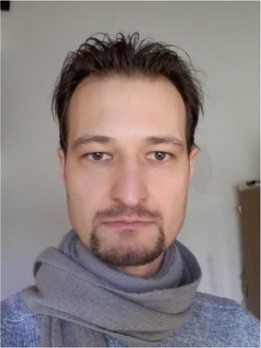 Frontal diffuse lighting: an evenly lit face with no dark patches or hot spots